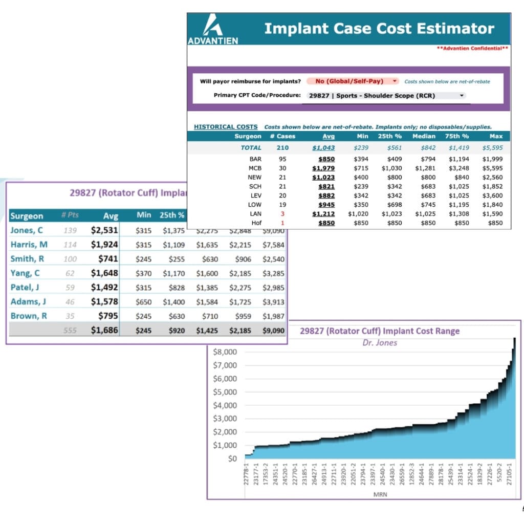 Orthopedic ASCs 2024 Growth and Challenges Advantien Implant Revenue